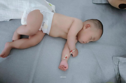偃师宝宝褶皱处擦粉还是油